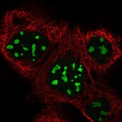 BRIX Antibody, Novus Biologicals 25 &mu;L; Unlabeled:Antibodies, Polyclonal